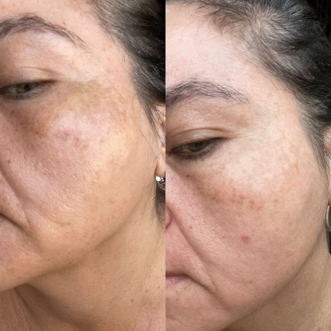 Antes e depois — uso contínuo do Ritual Glow